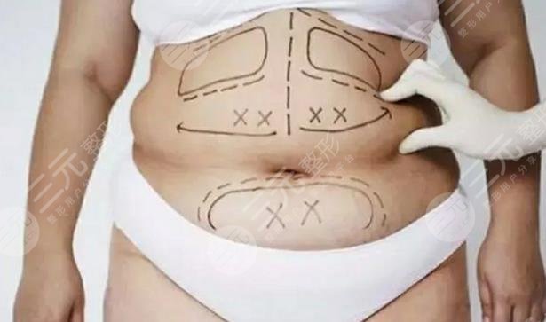 仰卧起坐能减肚子吗