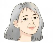 怎样治老年斑？靠谱方法分享！让激光“照亮”美肤！