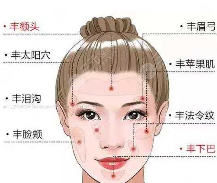 面部脂肪填充