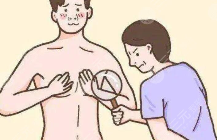 男人胸部吸脂