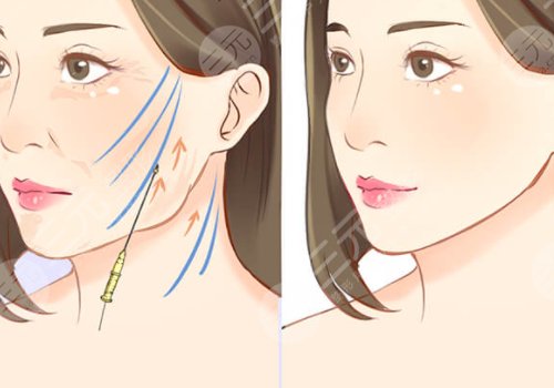 蔡海亮做v美减龄效果好吗?