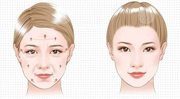 手术方式的选择