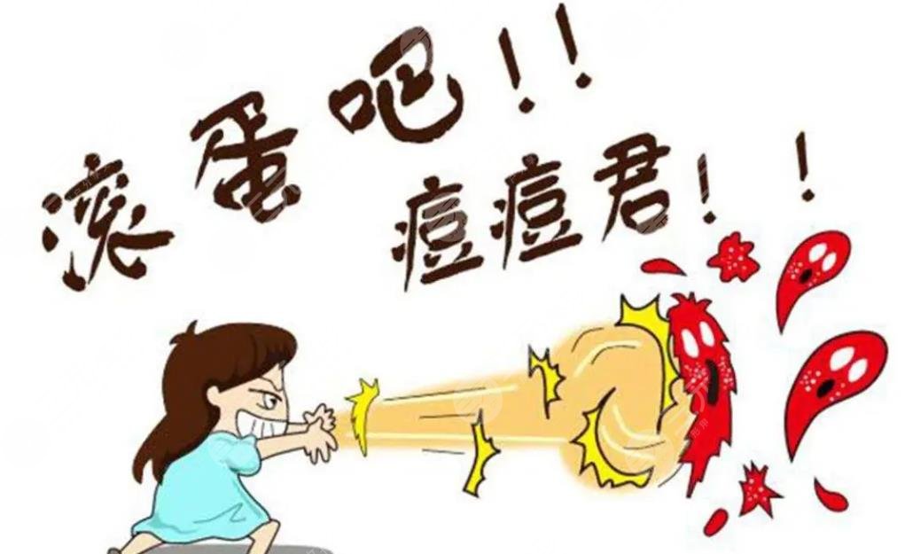 痤疮佳缓解方法