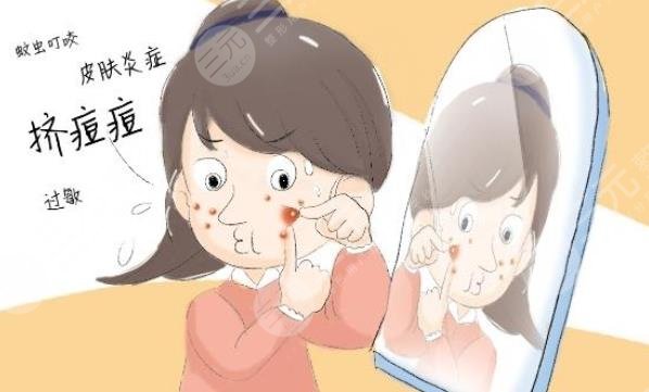 痤疮佳缓解方法