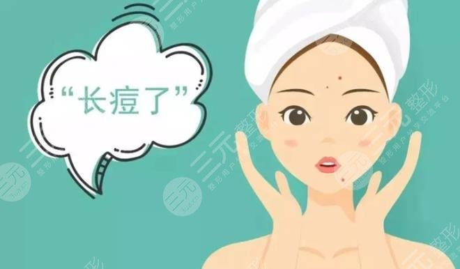 痤疮佳缓解方法