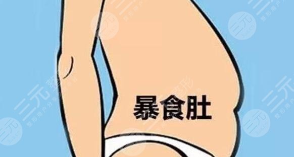 清肠胃减肥法有哪些?