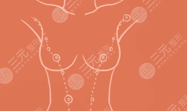 八大处杨庆华医生自体脂肪隆胸案例