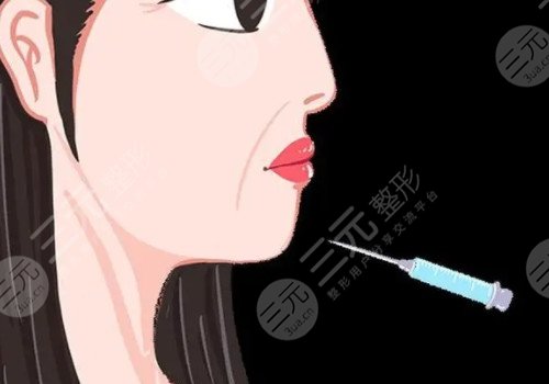 正规医院注射除皱价格是多少？