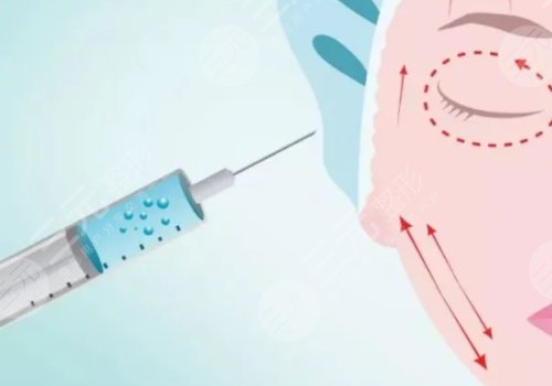 正规医院注射除皱价格是多少？