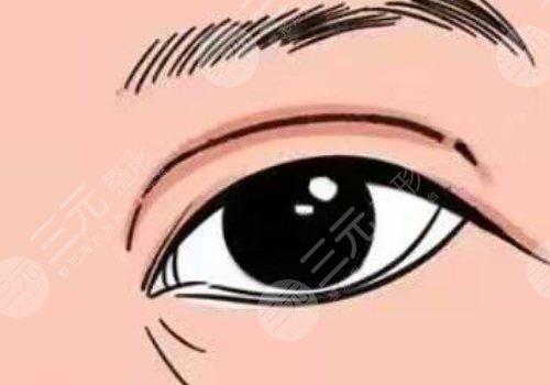 长沙美莱哪个医生做眼睛好?