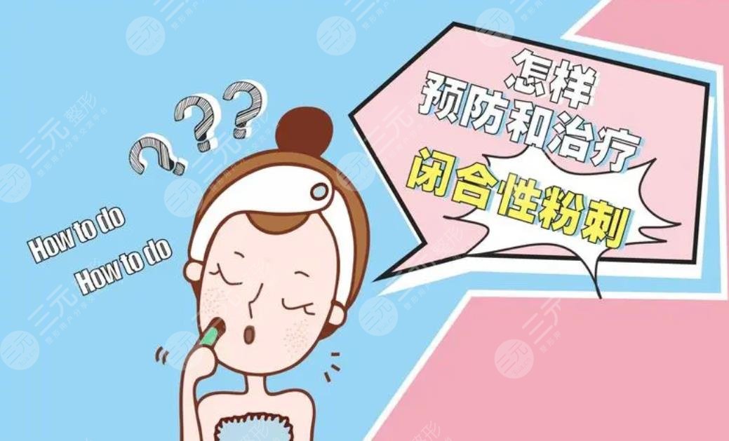 闭合性粉刺怎么彻底去除