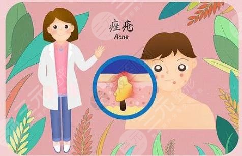 闭合性粉刺怎么彻底去除