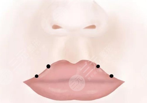 缩短人中的几种方法