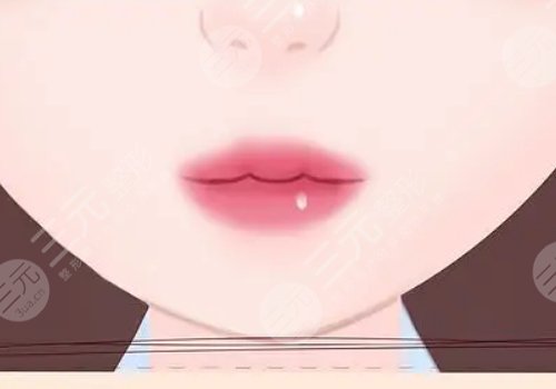 缩短人中的几种方法