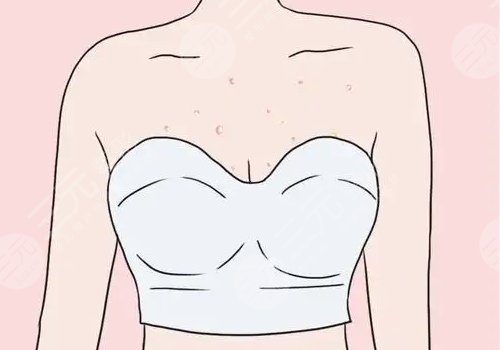 水滴形假体容易移位吗?