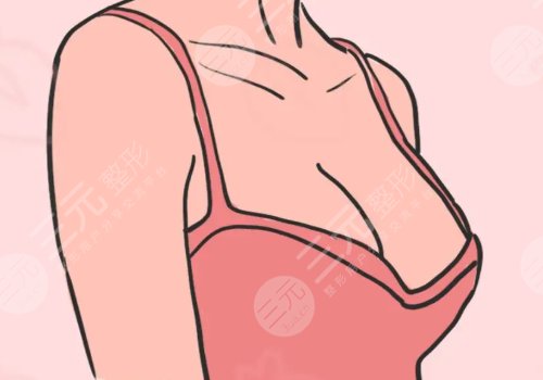 水滴形假体容易移位吗?