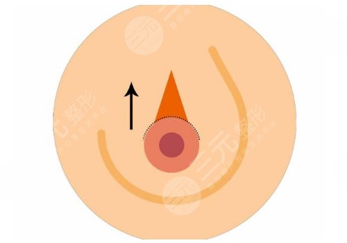 武汉美基元做胸的效果好吗?