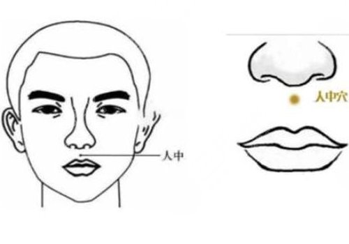 缩短人中的手术危险吗?