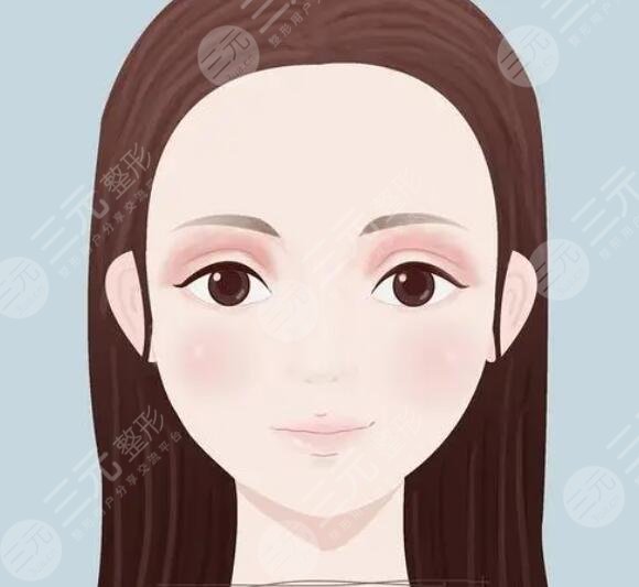 天津王文迪做双眼皮案例