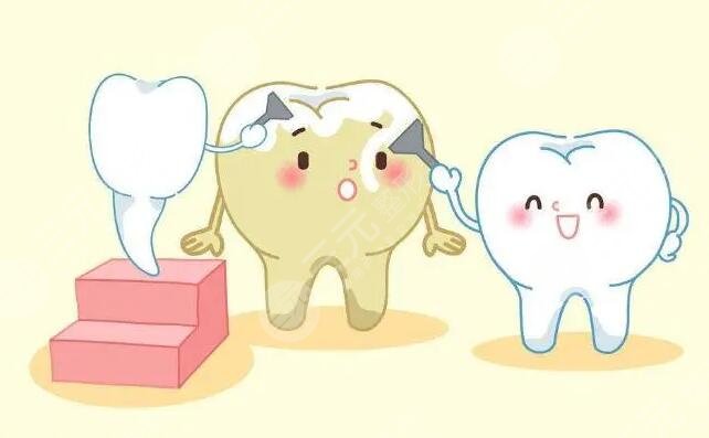 冷光牙齿美白的几个步骤是什么?