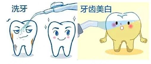 冷光牙齿美白的几个步骤是什么?