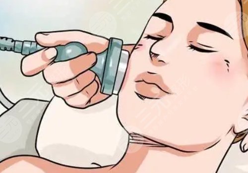 塑美极的后遗症有哪些?