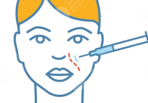 幼态减龄脸需要整什么？