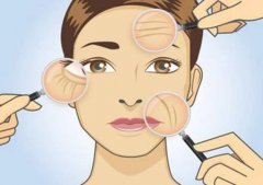 去除鱼尾纹的方法有哪些？4种对比，原理分析，来了解下！