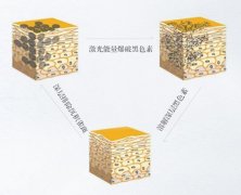 彩光祛斑效果好吗？美肤淡斑超轻松，入门高性价比医美之选！
