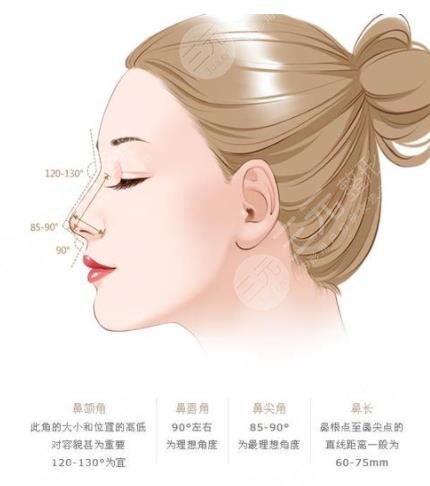 假体隆鼻