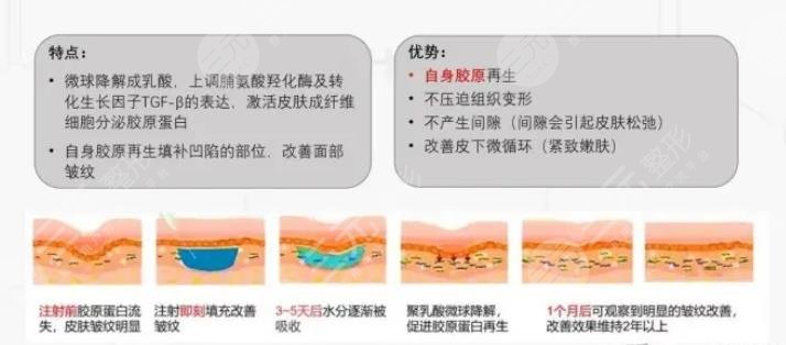 艾维岚