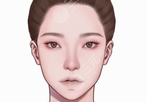 轮廓手术过程图片|网友恢复案例