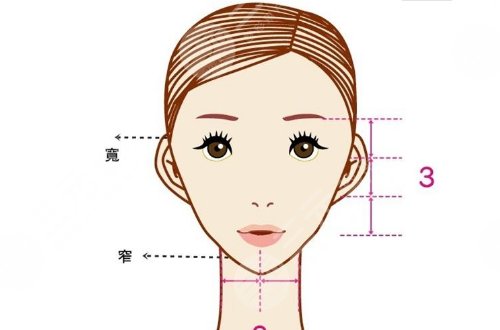 轮廓手术过程图片|网友恢复案例