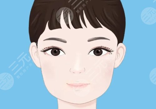 轮廓手术过程图片|网友恢复案例