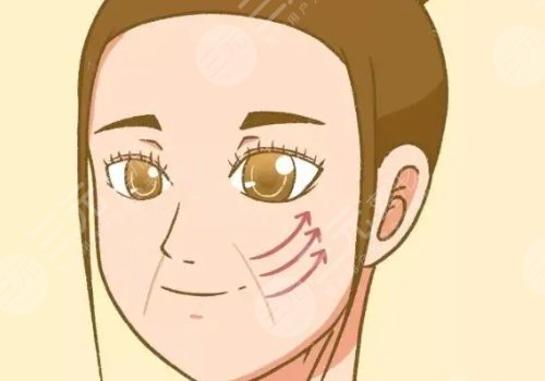 小拉皮手术切口图片