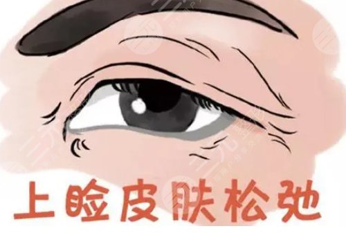 眼皮下垂解决方法有几种？