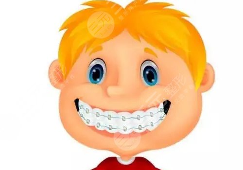 牙齿矫正多少钱价格表2023