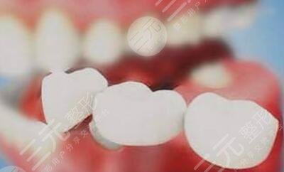 如何美白牙齿安全不伤牙？与大黄牙说byebye