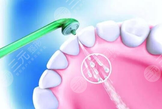 定期维持口腔健康