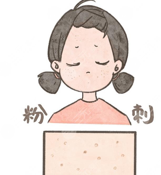 闭合性粉刺是什么样的图片