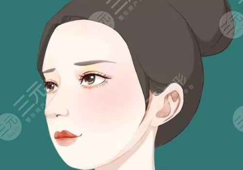 轮廓手术多久完全恢复?