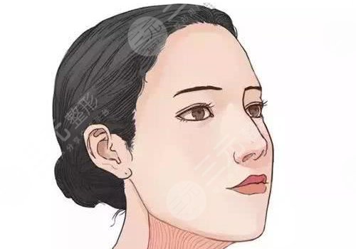 轮廓手术多久完全恢复?