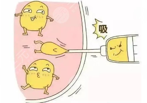 冯志丹吸脂怎么样?