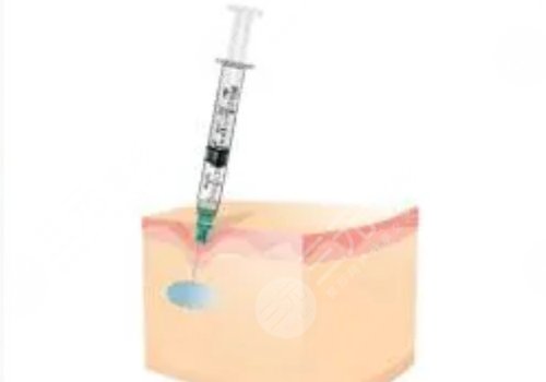 打玻尿酸10几年后比同龄人年轻吗？