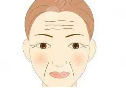 脸下垂提升有效的方法有哪些？拉皮手术详细介绍！