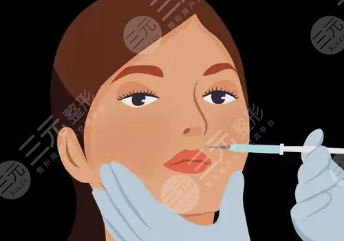 面部轮廓针是什么？