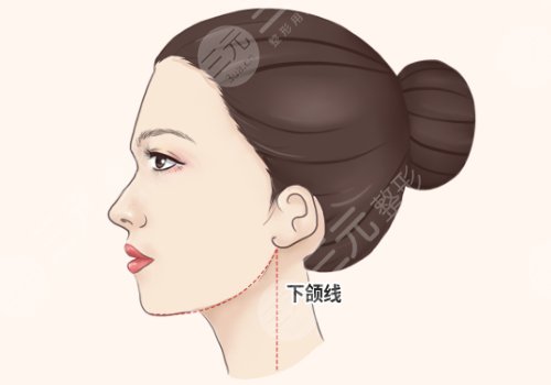 影响轮廓整形价格的因素有哪些?
