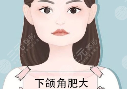 轮廓整形有哪些方法?