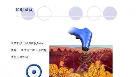深蓝射频适合多大年龄?