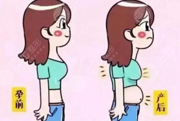 产后瘦身需要注意什么问题?